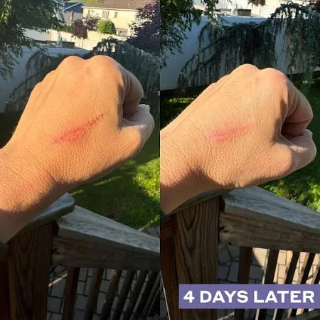 Daily SOS Rescue Hypochlorous Acid Facial Spray - Delune